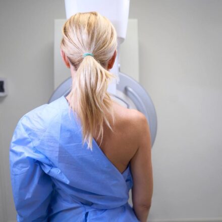 What to Expect, Cost and How to Prep